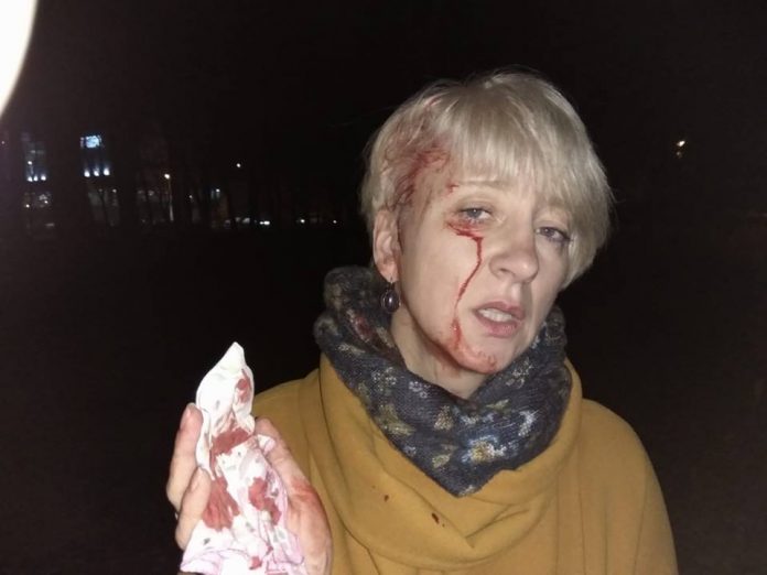У Полтаві невідомі побили суддю Ларису Гольник У Полтаві невідомі побили суддю Ларису Гольник