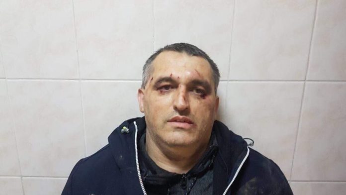 У Чернівцях побили активіста «Стоп корупції» У Чернівцях побили активіста «Стоп корупції»