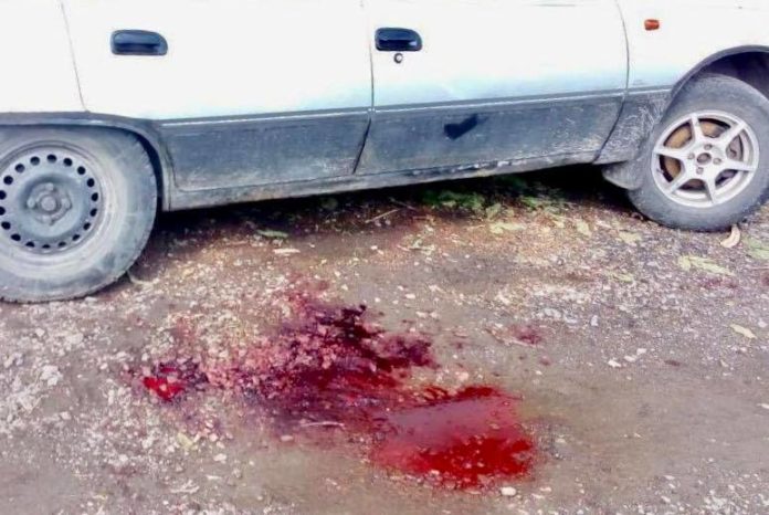 До вбивства чоловіка у Солонці причетний його брат — поліція До вбивства чоловіка у Солонці причетний його брат — поліція