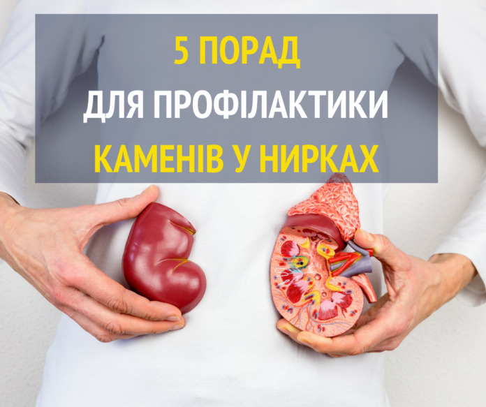 Як вберегтися від каменів у нирках. 5 порад від Супрун Як вберегтися від каменів у нирках. 5 порад від Супрун