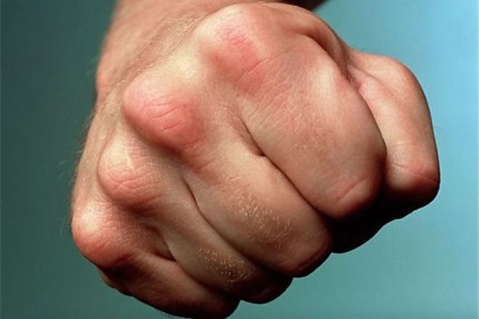 У Новояворівську чоловік до смерті забив свого товариша У Новояворівську чоловік до смерті забив свого товариша