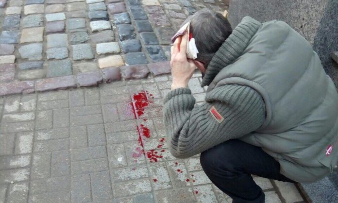 Шматок фасаду, що відколовся, розбив голову львів’янину (фото) Шматок фасаду, що відколовся, розбив голову львів’янину (фото)