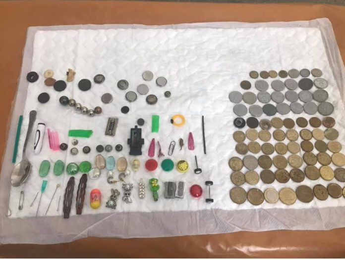 Львівські медики показали колекцію предметів, які заковтували діти Львівські медики показали колекцію предметів, які заковтували діти