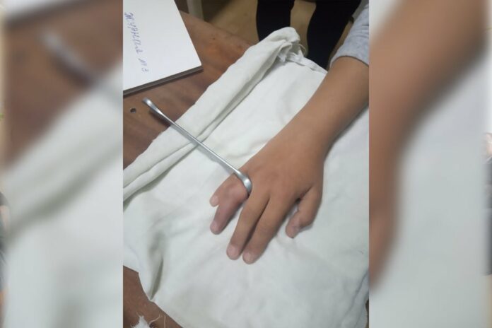 На Львівщині підліток запхав палець в автомобільний ключ – лікарі викликали рятувальників (фото) На Львівщині підліток запхав палець в автомобільний ключ – лікарі викликали рятувальників (фото)