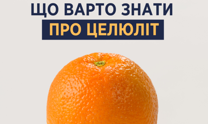 Супрун розклала по поличках усе про целюліт: є хороші й погані новини Супрун розклала по поличках усе про целюліт: є хороші й погані новини