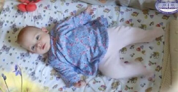 У Львові неонатологи вперше виходили дитину вагою 480 грамів У Львові неонатологи вперше виходили дитину вагою 480 грамів