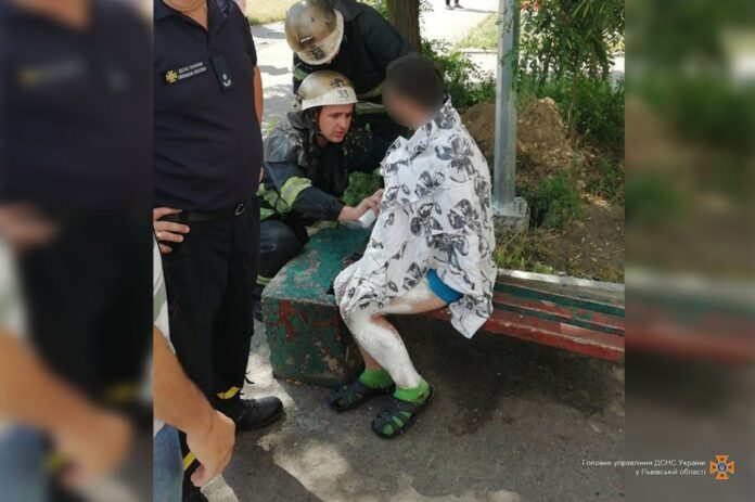 Під час пожежі у Червонограді постраждав хлопець Під час пожежі у Червонограді постраждав хлопець