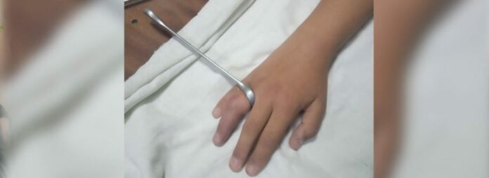 У Жовкві дитина засунула пальці у металеві сільця і не змогла витягнути У Жовкві дитина засунула пальці у металеві сільця і не змогла витягнути