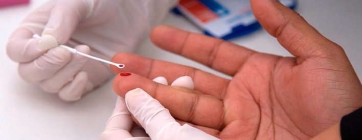 Вчені вперше за 19 років виявили новий штам ВІЛ