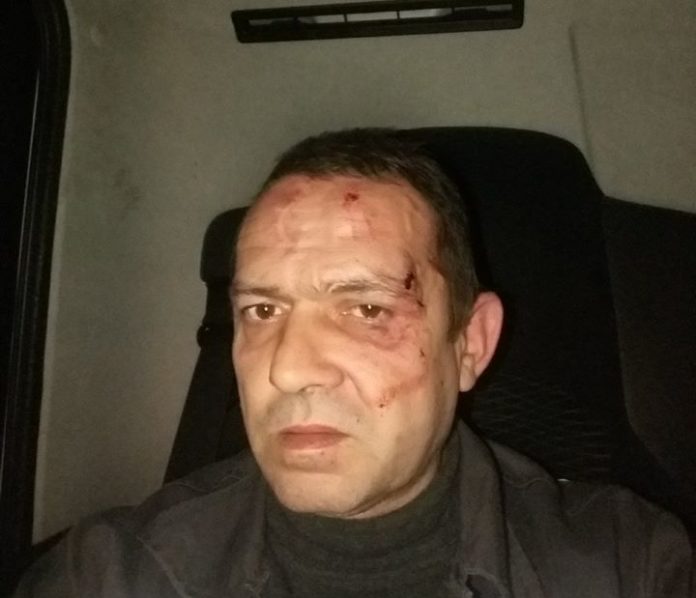 У центрі Львова побили бригаду сміттєвоза У центрі Львова побили бригаду сміттєвоза