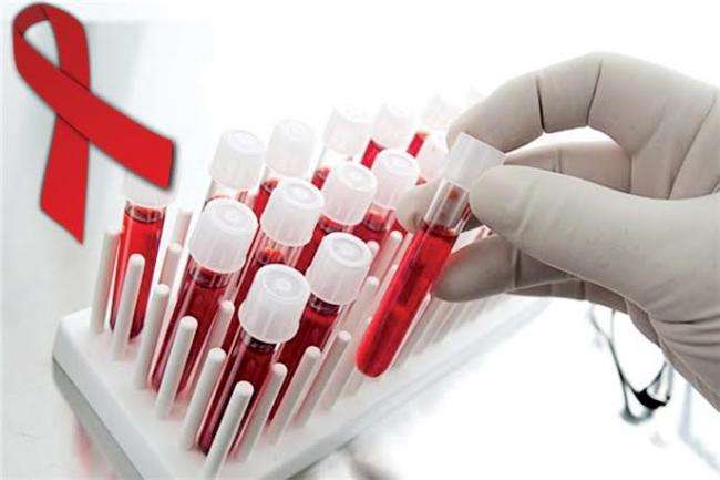 В Україні стартують акції безкоштовного тестування на ВІЛ