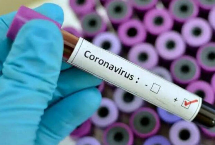 На Львівщині другий випадок коронавірусу COVID-19 діагностували у 59-річної жінки На Львівщині другий випадок коронавірусу COVID-19 діагностували у 59-річної жінки