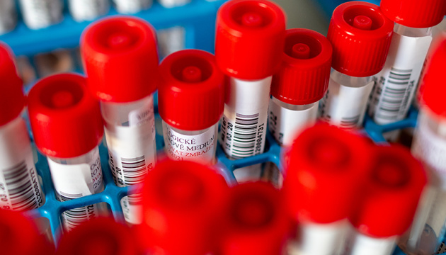 За вчорашню добу в Україні зафіксовано 32 нові випадки коронавірусу
