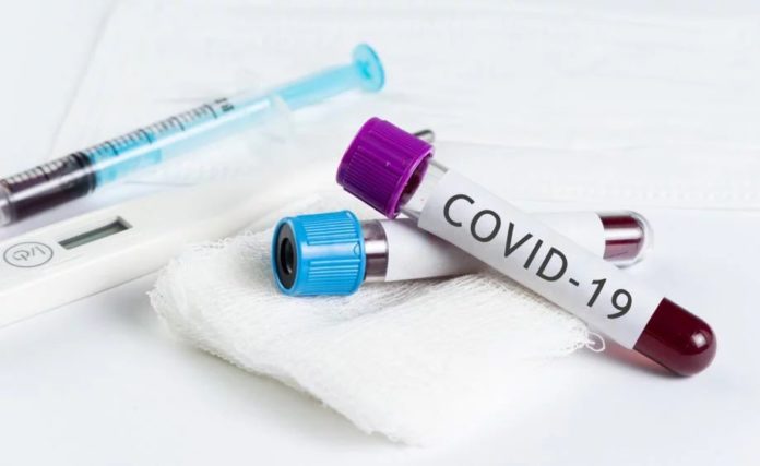 У Каховці на самоізоляції помер 36-річний чоловік з симптомами Covid-19 У Каховці на самоізоляції помер 36-річний чоловік з симптомами Covid-19