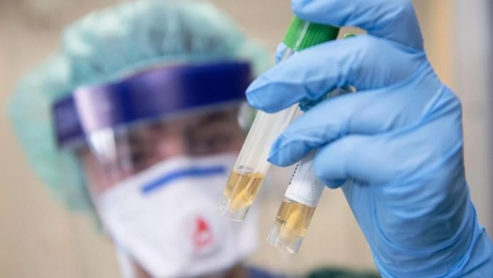 У Миколаївській області зафіксували перші 2 випадки коронавірусу У Миколаївській області зафіксували перші 2 випадки коронавірусу
