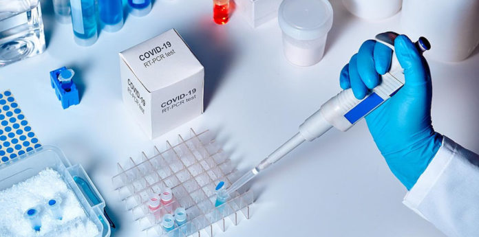 Степанов розповів, у яких умовах можуть робити ПЛР-тестування на COVID-19 Степанов розповів, у яких умовах можуть робити ПЛР-тестування на COVID-19