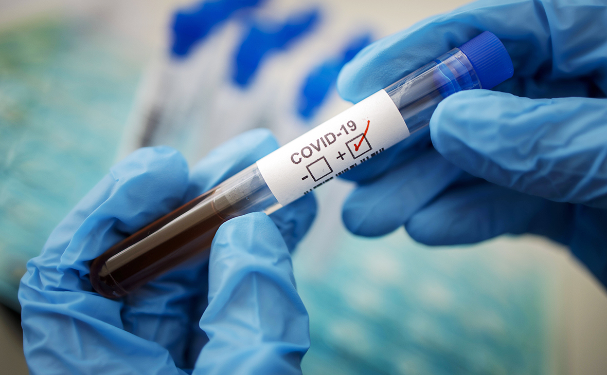 Більше сотні нових випадків коронавірусу у Львівській області