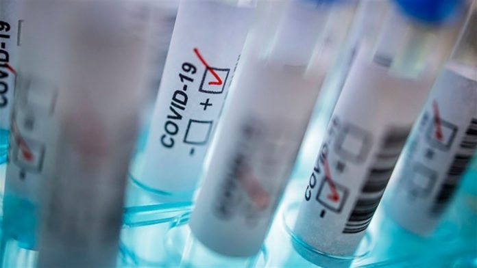 В Україні зменшилась кількість випадків коронавірусу за добу: статистика по регіонах В Україні зменшилась кількість випадків коронавірусу за добу: статистика по регіонах
