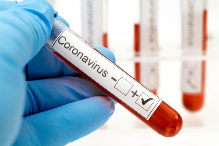 В Україні зафіксовано 5 231 нових випадків COVID-19 В Україні зафіксовано 5 231 нових випадків COVID-19