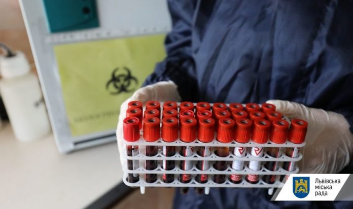 На Львівщині підтвердили коронавірус ще у 463 людей На Львівщині підтвердили коронавірус ще у 463 людей