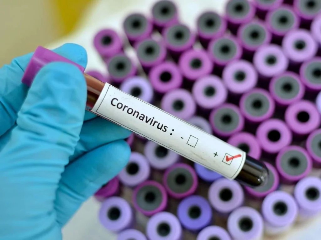 Стало відомо, скільки вакцин від коронавірусу отримає Україна