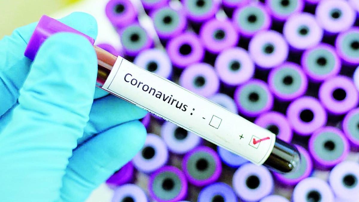 koronavirus-1
