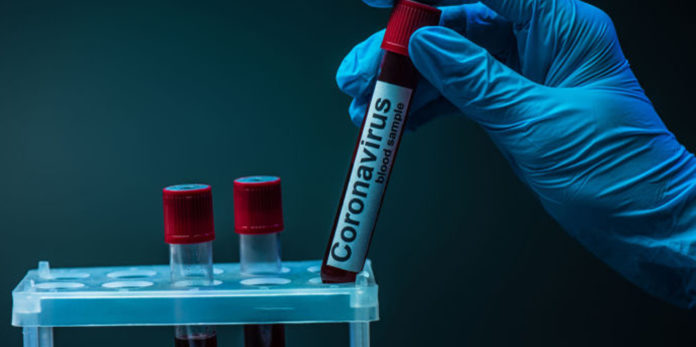 В Україні за добу понад 7000 нових хворих на COVID-19: статистика по регіонах В Україні за добу понад 7000 нових хворих на COVID-19: статистика по регіонах