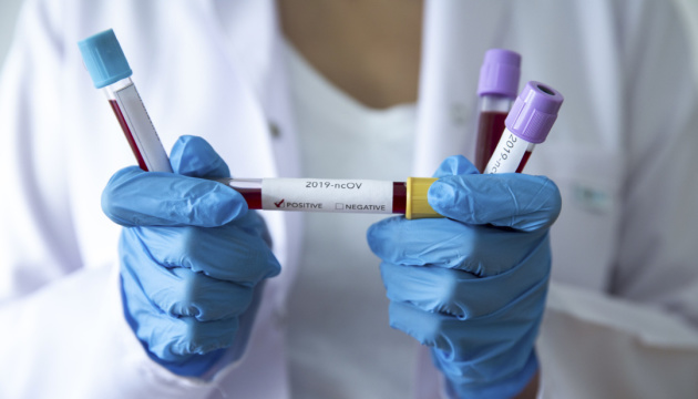 Вчені з'ясували, чи впливає група крові на ризик зараження та перебіг COVID-19
