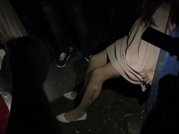 Львівські рятувальники визволяли ногу дівчинки з-поміж бетонних плит Львівські рятувальники визволяли ногу дівчинки з-поміж бетонних плит