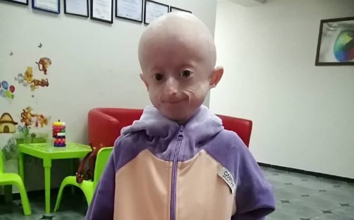 Від рідкісної генетичної хвороби у Львові померла 10-річна дівчинка Від рідкісної генетичної хвороби у Львові померла 10-річна дівчинка