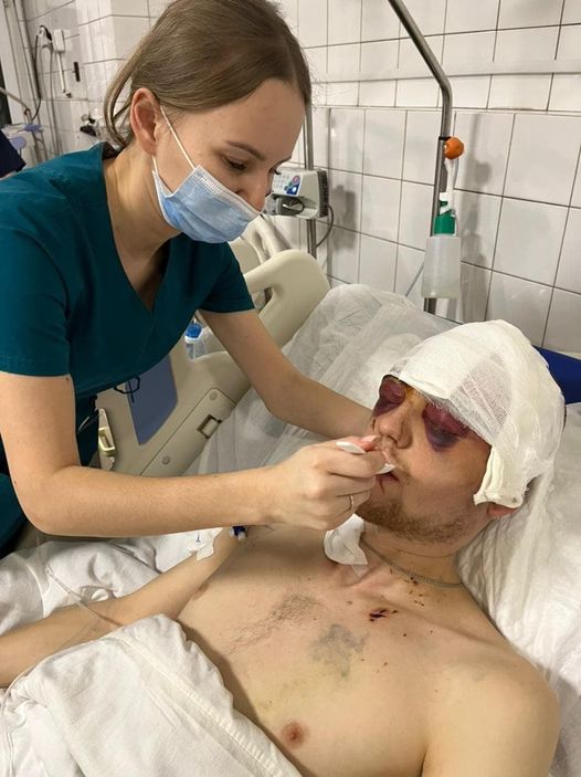 Хлопець з Харкова, у якого під час бомбардування розламався череп, отямився (фото) - 2