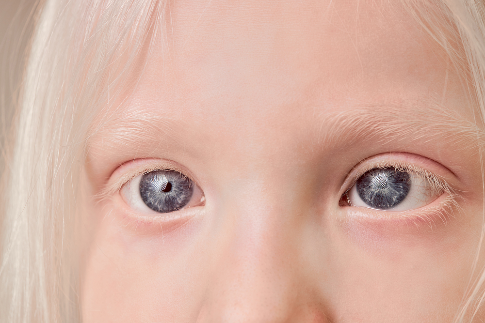 close-up photo of albino child eyes
