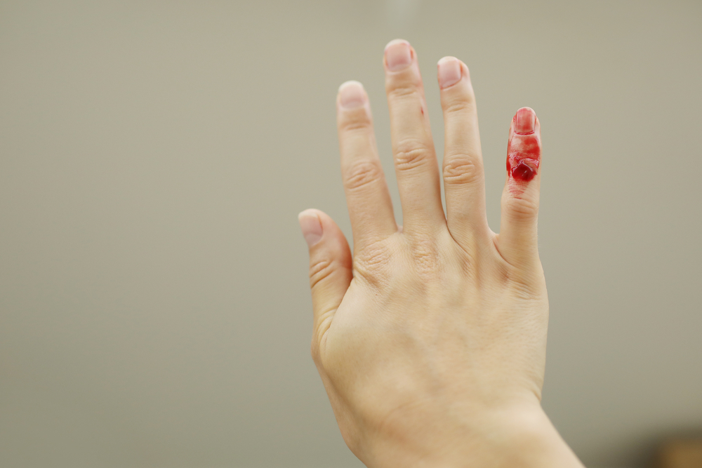 жіноча рука з порізанем пальцем, з якого тече кров