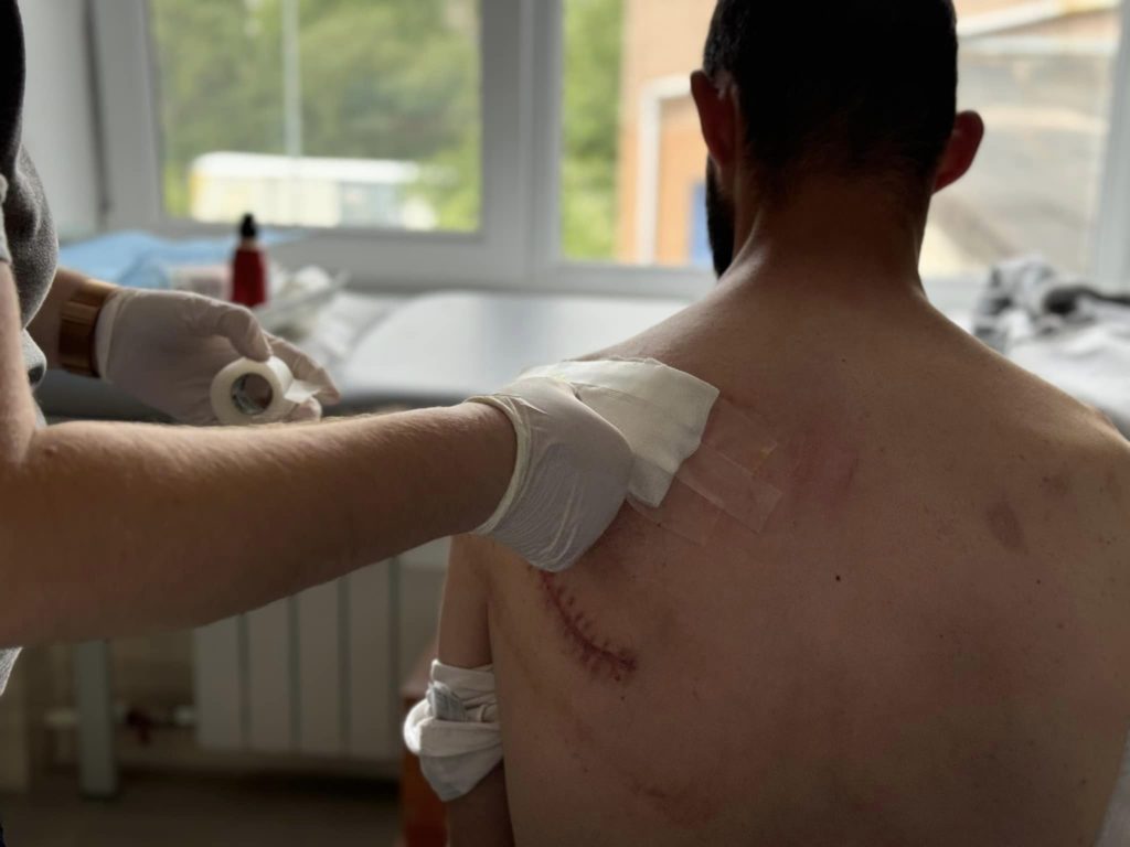 Львівські лікарі прооперували пацієнта зі складним переломом лопатки - 2