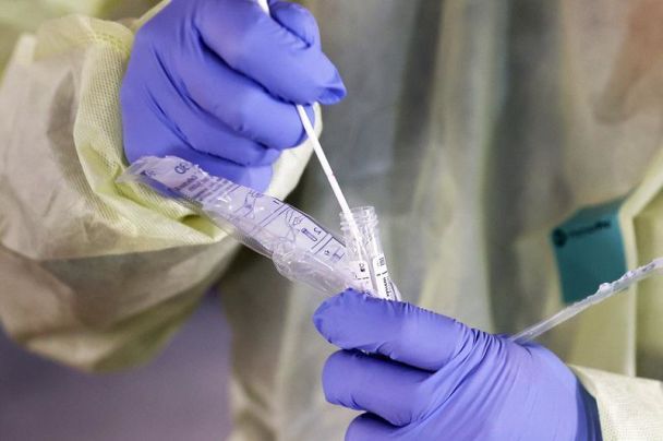 На Львівщині зафіксували перший випадок дифілоботріозу: що за недуга та які симптоми - 2