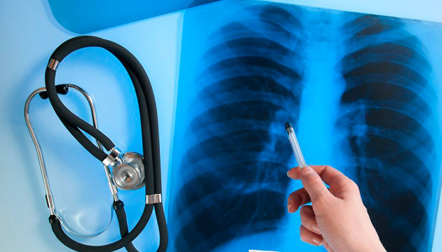 Від СНІДу на Львівщині померли 15 людей: що треба знати про недугу - 4