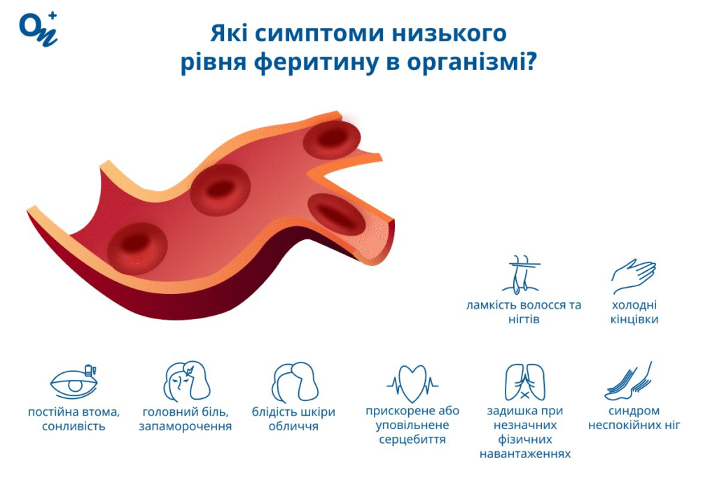 «Це не діагноз, а реакція організму», — львівська лікарка про метеочутливість та її протидію - 2