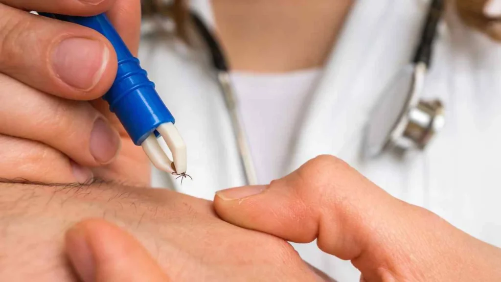 «Укус кліща — це доволі часте явище»: як захистити себе та своїх домашніх улюбленців - 2