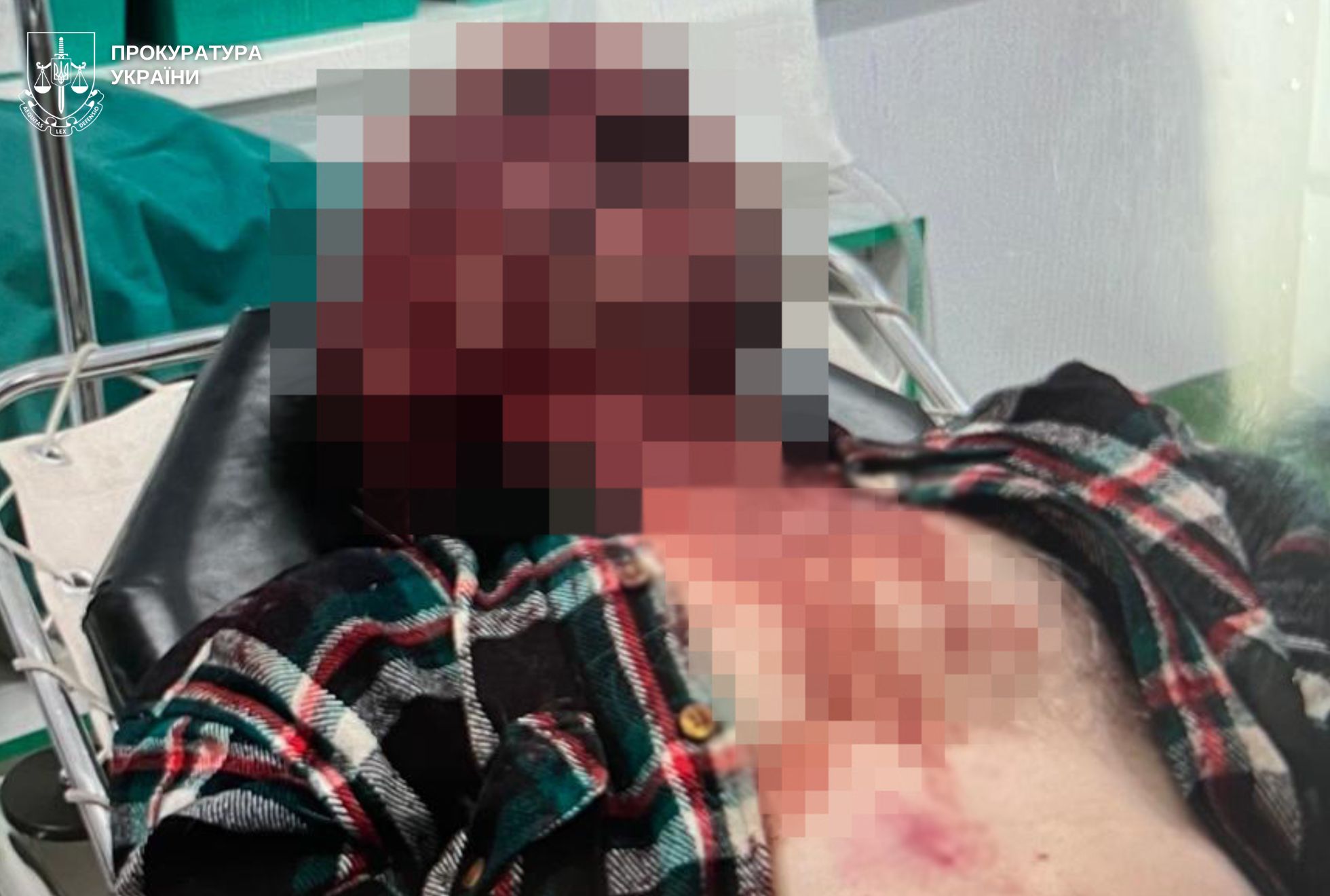 На Львівщині донька побила літнього батька металевою кочергою - 1