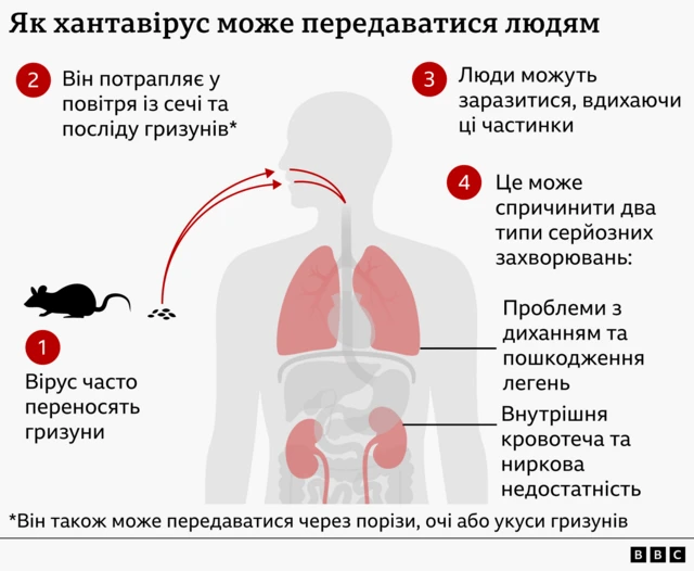 «Смертність до 30%»: що таке хантавірус, як від нього вберегтися і чи циркулює на Львівщині - 4